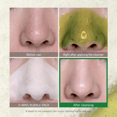 SOME BY MI BYE BYE BLACKHEAD 30 DAYS MIRACLE GREEN TEA TOX BUBBLE CLEANSER