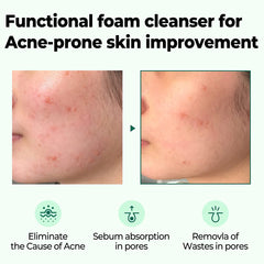 SOME BY MI AHA BHA PHA 30 DAYS MIRACLE ACNE CLEAR FOAM